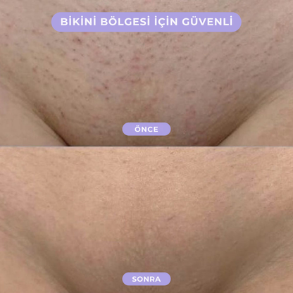 Glorence™ Ağrısız & Pürüzsüz Tüy Alıcı